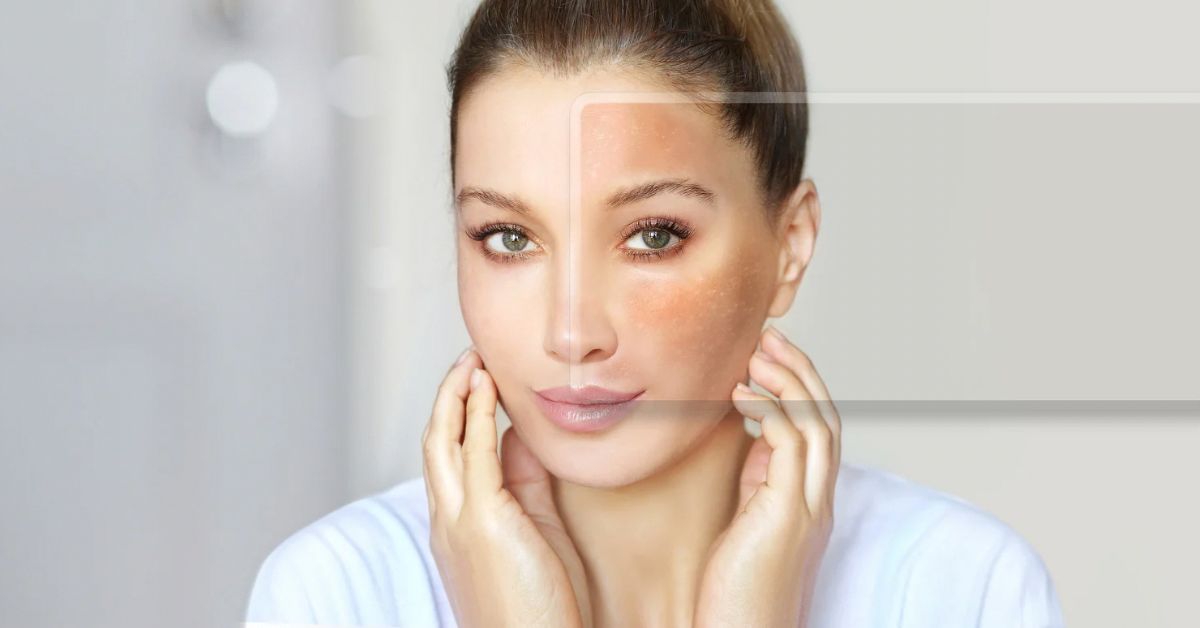 niacinamide for reducing facial redness and soothing skin