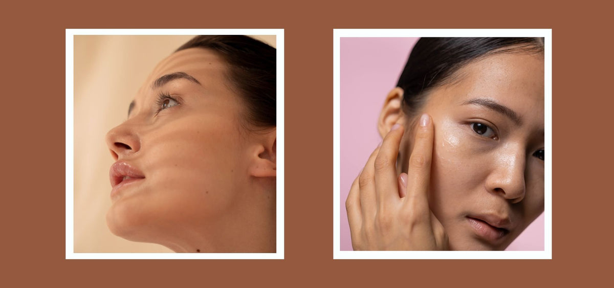 Dry Skin vs Dehydrated Skin: Know The Difference & Skincare Routine - Pnk Beauty