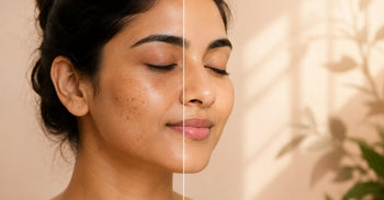 pigmentation and dark spots on Indian skin before and after fading