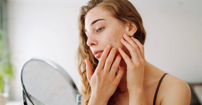 Sensitive skin care routine with gentle skincare products for irritation-free skin