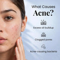 Evoaked Acne Series – Acne Control Face Wash (2.5% Benzoyl Peroxide) Clinically Proven Acne Control with Hydration Protection Pnk Beauty