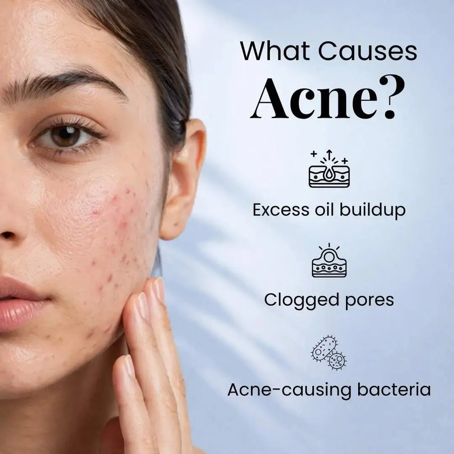 Evoaked Acne Series – Acne Control Face Wash (2.5% Benzoyl Peroxide) Clinically Proven Acne Control with Hydration Protection Pnk Beauty