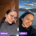 Evoaked Acne Series – Travel Acne Control Combo